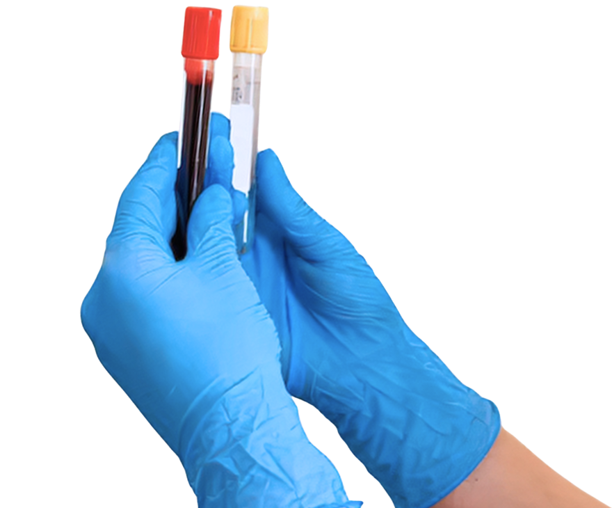 Eigenbluttherapie Orthopädie Königsallee Düsseldorf